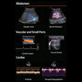 Diagnostic Ultrasound