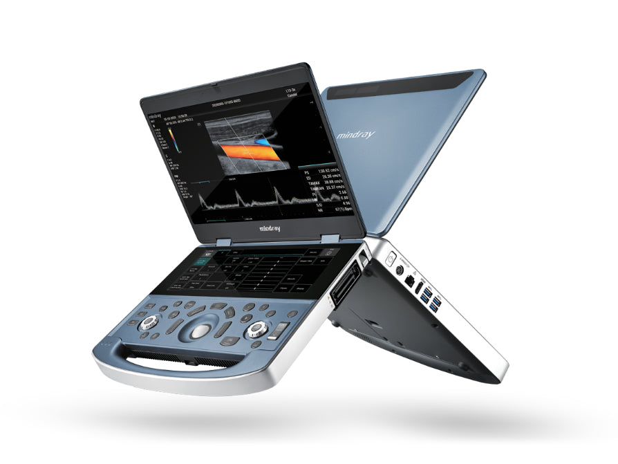 Mobile Ultrasound